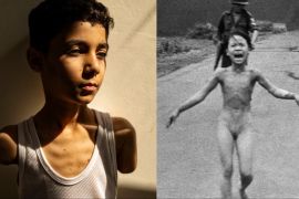 Mahmoud Ajjour, nine (left), who was injured during an Israeli attack on Gaza City in March 2024, finds refuge and medical help in Doha, Qatar, on June 28, 2024 [Samar Abu Elouf, for The New York Times] Kim Phuc, nine (right) is seen running down Route 1 near Trang Bang after a South Vietnamese plane accidentally dropped its flaming napalm on its own troops and civilians, on June 8, 1972. The terrified girl ripped off her burning clothes while fleeing [Nick Ut/AP]